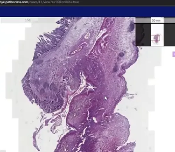 Tıbbi Patoloji Eğitimi Çevrim İçi Gerçekleşti 