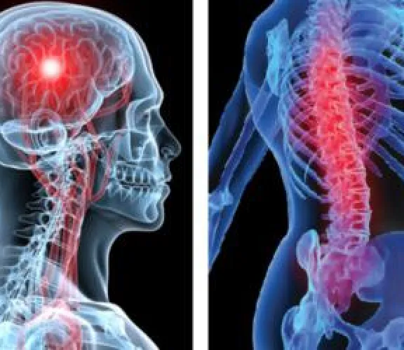  Nöroşirurji Hemşireliği