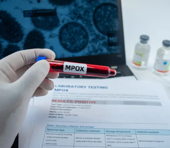 mpox